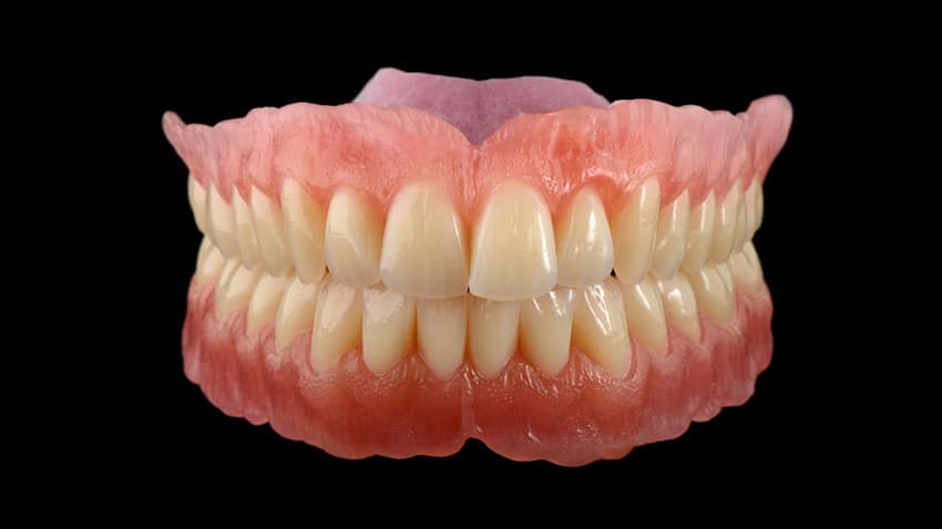 Herausnehmbarer Zahnersatz - Dentallabor