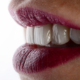 Zahnästhetik – von Inlays, Veneers bis zu Einzelkronen